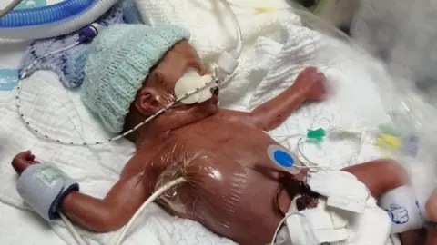 Irwin Mitchell / Rebecca Walker Baby Charlie-Jay