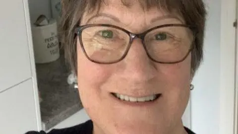 Oxfordshire County Council /Sarah Howes Sarah Howes after the dental implants surgery