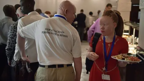 AFP Vice President of the Albino Association of Malawi Alex Michila (L) talks to a delegate during a regional conference on albinism organised by the United Nations (UN) to discuss potential measures and legislation to protect people with albinism in Africa from discrimination and superstitious attacks, in Dar es Salaam on June 18, 2016