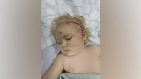 0fcbbf90-00bf-11f0-8b2a-c7cde80a6cf3.png 'Doctors mistook my baby's brain tumour as teething'