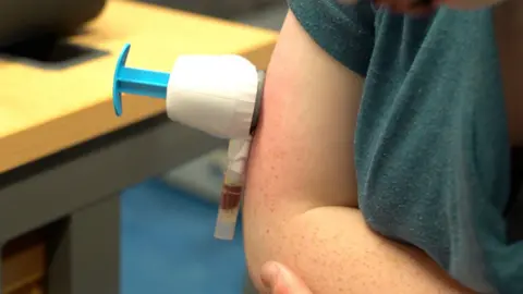A vacuum-type device attached to the arm of a young girl in a medical setting.