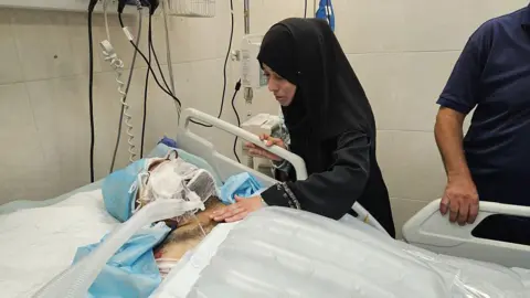Hamdi Al-Najjar is visited by his niece, Samah Al-Najjar, while in the intensive care unit at Nasser Hospital in Khan Yunis, Gaza, after an Israeli airstrike hit his home. 