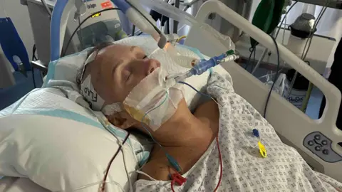 Warren Bullock A woman in a hospital bed with tape over her mouth and a large breathing tube at the corner of her mouth