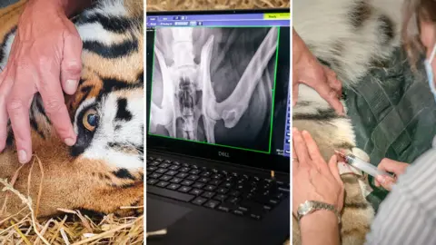 PA Media Composite image of procedure