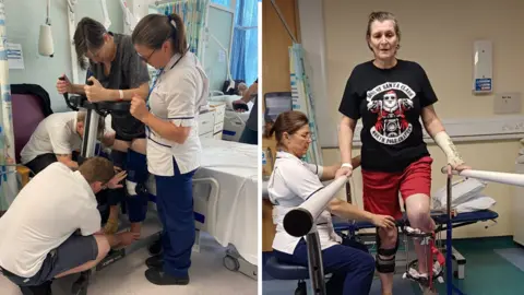 Supplied Two photos side by side showing Janet being rehabilitated by hospital teams.
