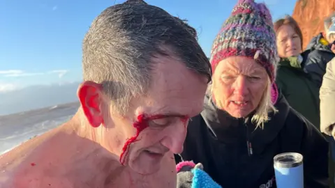 Mike Brown Mike Brown with cuts to his head. He is looking down and has just come out of the water. There is a woman stood next to him holding a blue flask.