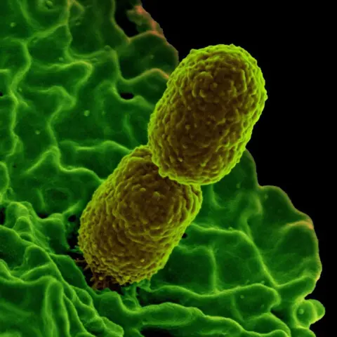 Universal Images Group via Getty Images Colorized scanning electron micrograph showing carbapenem-resistant Klebsiella pneumoniae interacting with a human neutrophil