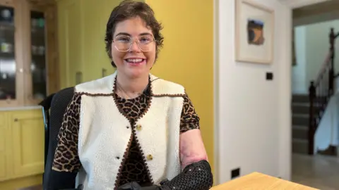 Chris Craddock/BBC Lily McGarry is smiling at the camera. She is wearing a brown top with a cream waistcoat with brown edging and glasses and has short brown hair.
She has a black prosthetic limb at elbow level on her left arm.