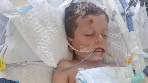 Family photo A young boy lies in a hospital bed with various medical equipment including breathing tubes.
