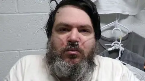 A man with black hair and a long black/grey beard has a breathing tube in his nose