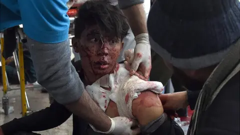 AFP a wounded boy with blood on his face being bandaged by medical staff