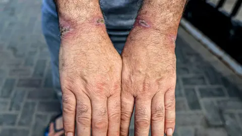 Getty Images detainee shows cuts on wrists after release