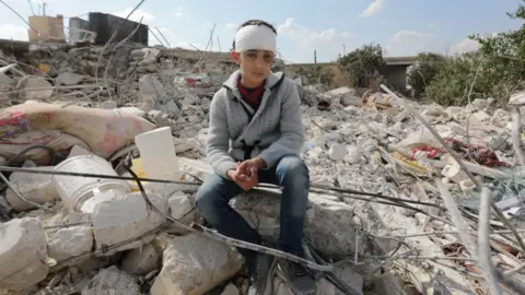 AFP via Getty Images An injured Syrian boy, who lost his family in the earthquake, sits amid the rubble of his home in the town of Jindayris, north-western Syria. Photo: February 2023