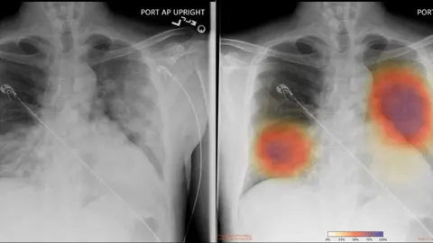 UCSD HEALTH Lung scans