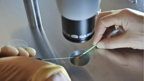PA Media IVF procedure