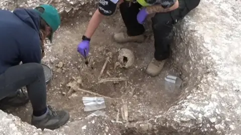 Bournemouth University Skeleton remains