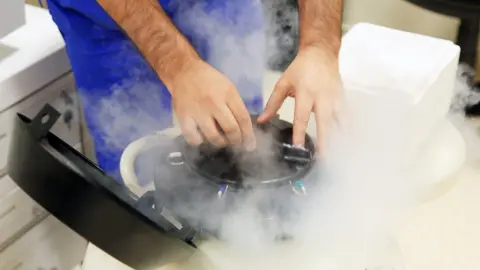 Getty Images Freezing eggs for storage