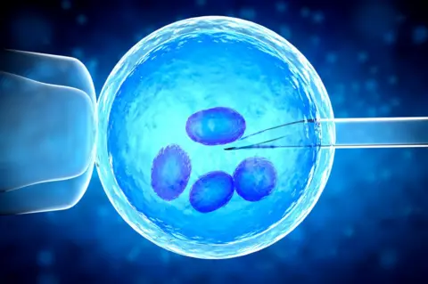 Getty Images IVF process