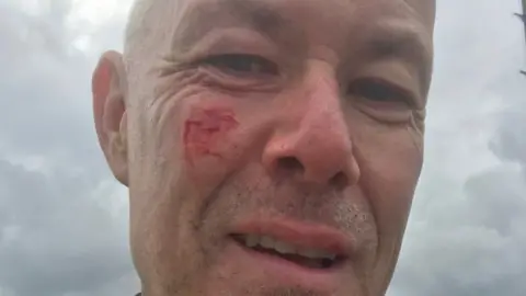 Phil Williams Cyclist Phil Williams with facial injuries after the hit and run
