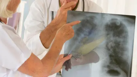 Getty Images medical staff looking at a lung scan
