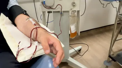 A man's arm who is donating plasma.