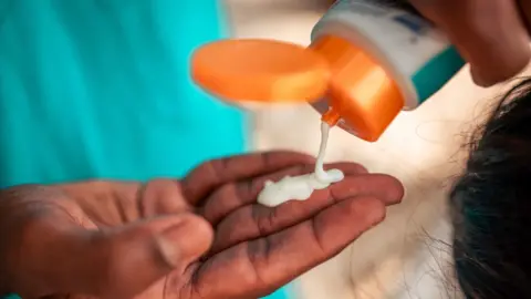 Someone is squeezing sunscreen from an orange, white and blue tube on to the palm of their hand