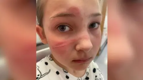 Charlotte Bella with a wound on her face across her nose and on her forehead. She is looking at the camera.