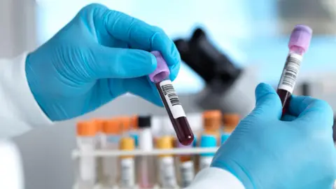 Two gloved hands hold vials of blood. Several vials in a rack can be seen in a blurred background.