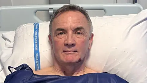 A man with short grey hair, wearing a blue hospital gown, lying on a white pillow in a hospital bed. He is staring at he camera.