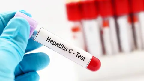 A test tube of blood has a sticker on it saying Hepatitis C - Test 