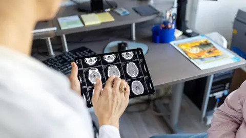 A women in a white doctors coat showing brain scans to someone off screen 