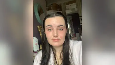 Eczema flare-ups sealed 22-year-old's eyes and mouth shut