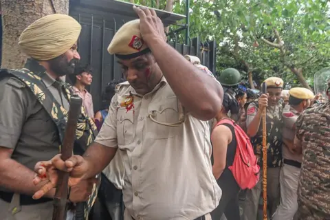 Getty Images An injured Delhi police jawan during a protest march, at Sansad Marg on July 20, 2026 in New Delhi, India. 