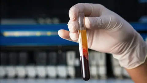 Getty Images Testing blood for cancer