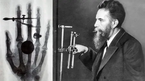 ullstein bild Dtl/Getty Images Wilhelm Röntgen and a close-up of his hand