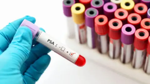 Getty Images A blue-gloved hand holds a test tube marked "PSA" with rows of more test tubes in the background - they have brightly-coloured lids in red, yellow and purple.