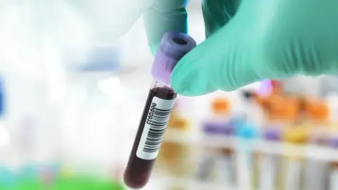 Getty Images surgical gloved hand holding test tube blood sample