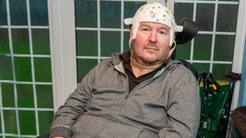 A man wearing a grey tracksuit top sits in a wheelchair in front of closed French doors, with a medical helmet which commonly protects the head when experiencing seizures