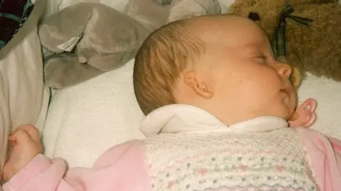 Supplied Olivia Howe as a baby, lying asleep in a cot, with her head on once side showing her underdeveloped right ear