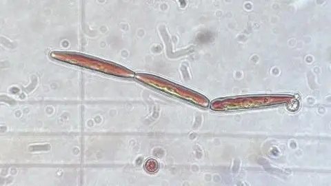Emily Broadwell The novel Ancylonema alga under a microscope. It is a small cell made up of three long brown segments.