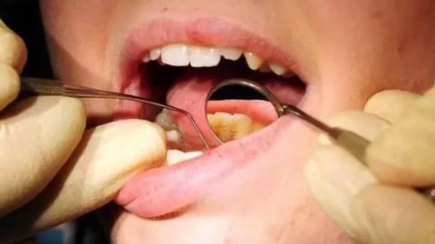 Teeth being examined 