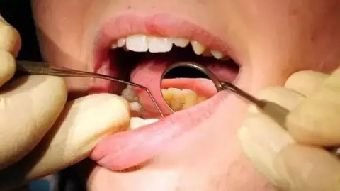PA Teeth being examined 