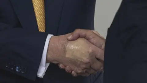 Getty Images Bruising is seen on President Donald Trump's hand while shaking the hand of Crown Prince and Prime Minister of the Kingdom of Bahrain Salman bin Hamad bin Isa Al Khalifa at the White House 16 July, 2025.