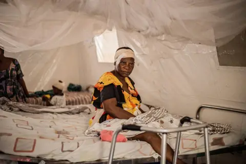 JOSPIN MWISHA/AFP A wounded patient, her head covered in bandages, sits on a bed at the International Committee of the Red Cross hospital as she suffers from several injuries sustained during the recent fighting, in Goma, on January 20, 2025. She is wearing a yellow and black dress and the bed she sits on is in a row inside a tent.