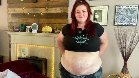 A woman with red hair has rolled up her black t-shirt to reveal a large hernia on her stomach. She is wearing dark leggings and her dark top has the words "HERNIA MUM" embroidered on it. There is a fireplace in the background, a red chair, a plant and framed records on the wall.