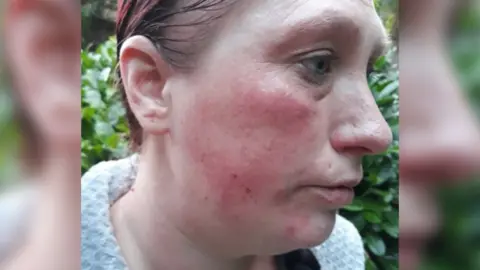 Nottinghamshire Police Rebecca Alexander with injuries to her face