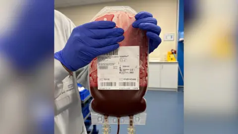 NHS Blood and Transplant/Caters Photographic/PA Wire Handout photo issued by NHS Blood and Transplant of a blood donation packet and a medic wearing a lab coat and blue gloves holding it up to the camera.