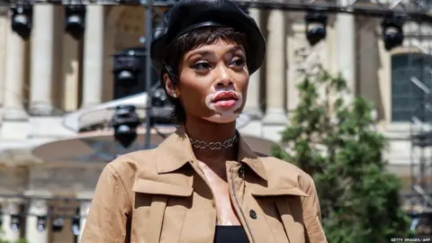 Getty Images/AFP Winnie Harlow