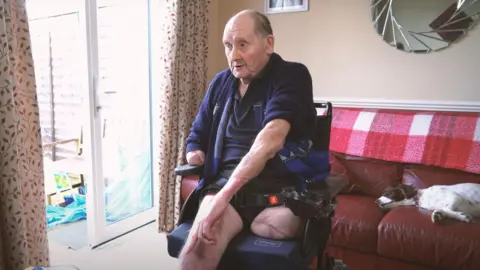 Sussex Poilce Vic Franklin, 79, from Bognor, sitting in a wheelchair having had two limbs amputated following an attack by two Rottweilers. Pictured on the sofa behind him is his pet Spaniel.