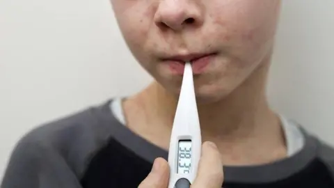 A young boy with a measles rash on his face and neck takes his temperature using a digital thermometer. He wears a black and grey sweatshirt over a white t-shirt.